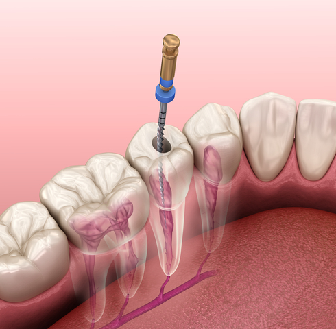 מרפאת השיניים ysl dentists